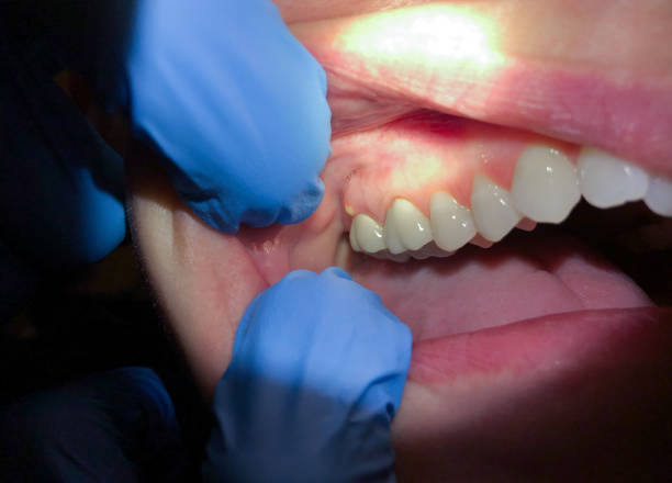 Best Emergency Dentist for Knocked-Out Tooth in Banning, CA